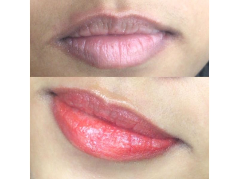 Neutralização Labial